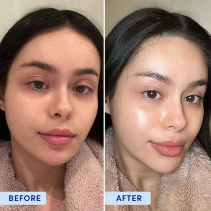 Orb Crushing PDRN Serum