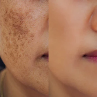 Korean Niacinamide 20 Dark Spot Serum